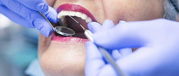 Best Emergency Dental Care for Broken or Chipped Teeth in Heber, CA